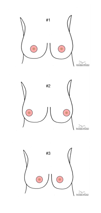12 different breast shapes and sizes